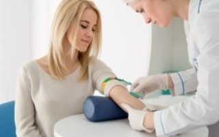 Глюкозотолерантный тест крови при беременности: как сдавать, нормы и расшифровка