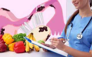 Способна ли диета помочь в лечении эндометриоза