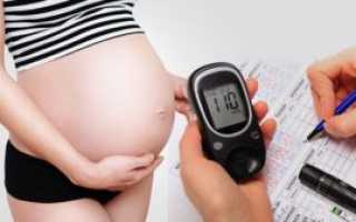 Анализ крови на сахар при беременности: норма, таблицы, расшифровка