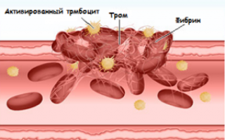 Как сдать анализ крови на свертываемость и тромбоциты