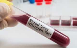 Анализ на мочевую кислоту в крови: диагностика, норма