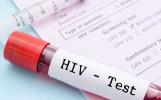 Причины ложного результата на ВИЧ