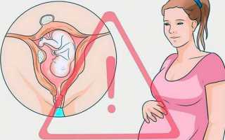 Миомэктомия при беременности