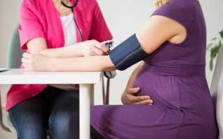 Как сдавать анализ на глюкозу при беременности