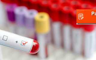 Расшифровка анализа крови на ВИЧ