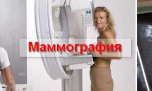 Почему маммография очень важна для женщин