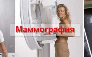 Почему маммография очень важна для женщин