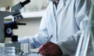 Биохимический анализ крови на СРБ и его расшифровка