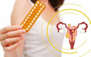 Применение гормональных препаратов при лечении миомы матки