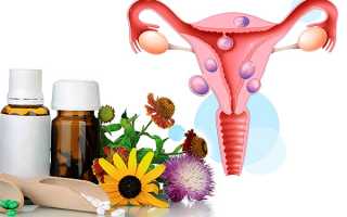 Применение гомеопатии при лечении миомы матки
