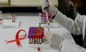 Что это такое анализ на антитела к ВИЧ